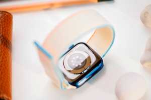 Apple planning blood sugar sensor for 2021 Watch
